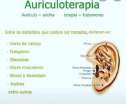 Auriculoterapia 